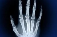 Skeletal Anatomy 3D: Awesome Learning Tool